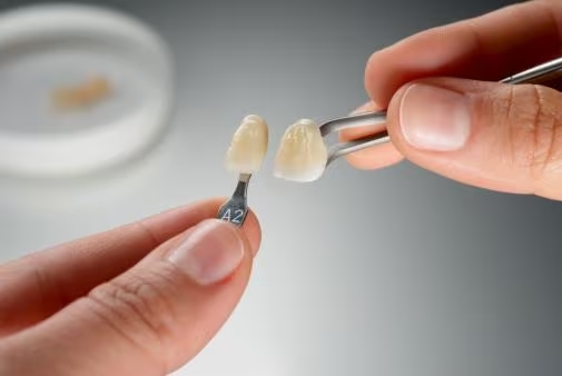 Răng sứ 3M™ ESPE™ Lava™ Esthetic là gì?